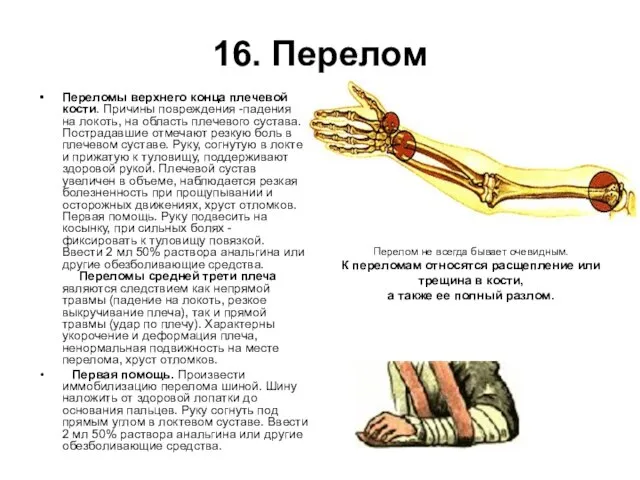 16. Перелом Переломы верхнего конца плечевой кости. Причины повреждения -падения на локоть,