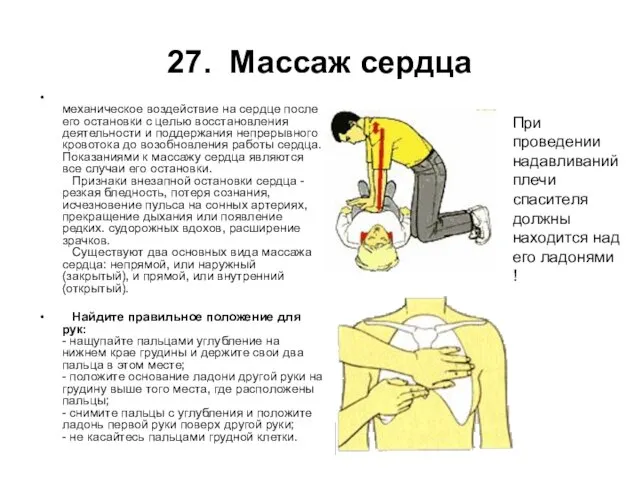 27. Массаж сердца механическое воздействие на сердце после его остановки с целью