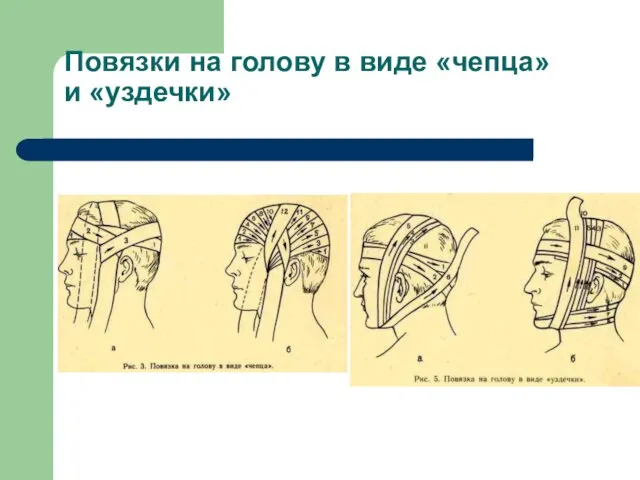 Повязки на голову в виде «чепца» и «уздечки»