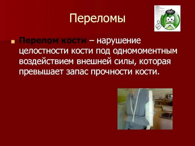 Переломы Перелом кости – нарушение целостности кости под одномоментным воздействием внешней силы,