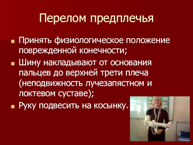 Перелом предплечья Принять физиологическое положение поврежденной конечности; Шину накладывают от основания пальцев