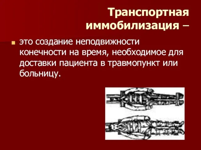 Транспортная иммобилизация – это создание неподвижности конечности на время, необходимое для доставки