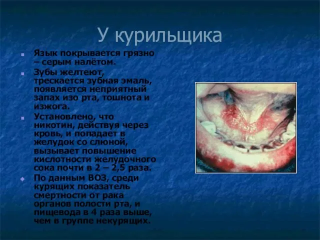 У курильщика Язык покрывается грязно – серым налётом. Зубы желтеют, трескается зубная