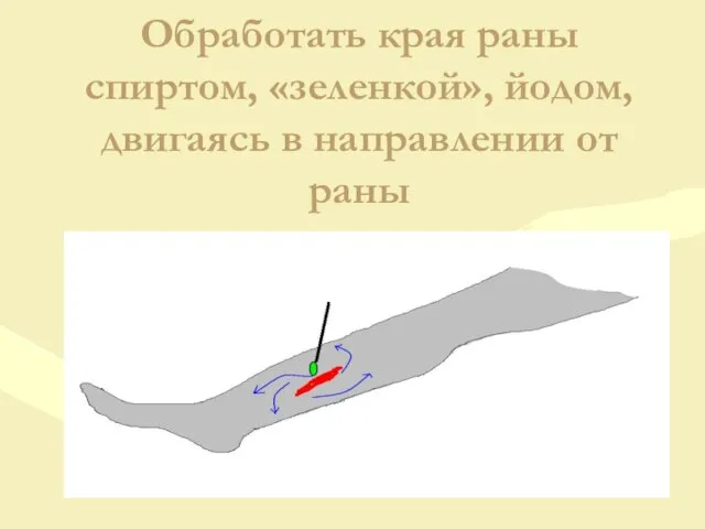 Обработать края раны спиртом, «зеленкой», йодом, двигаясь в направлении от раны