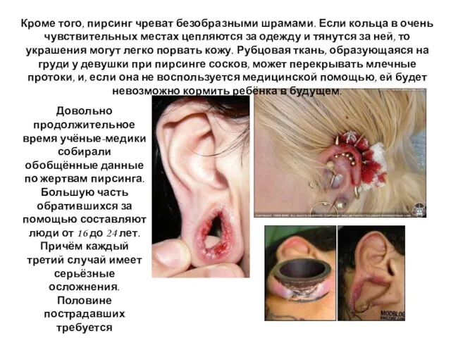 Довольно продолжительное время учёные-медики собирали обобщённые данные по жертвам пирсинга. Большую часть