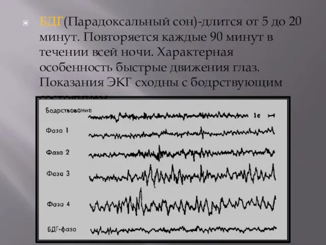 БДГ(Парадоксальный сон)-длится от 5 до 20 минут. Повторяется каждые 90 минут в