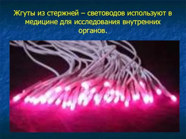 Жгуты из стержней – световодов используют в медицине для исследования внутренних органов.