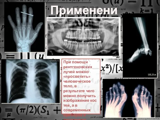 При помощи рентгеновских лучей можно «просветить» человеческое тело, в результате чего можно