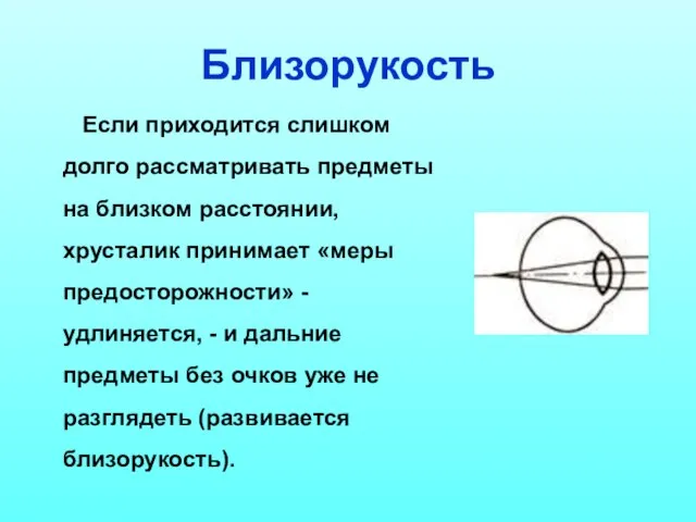 Близорукость Если приходится слишком долго рассматривать предметы на близком расстоянии, хрусталик принимает