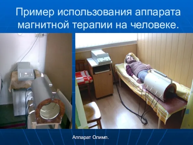 Пример использования аппарата магнитной терапии на человеке. Аппарат Олимп.