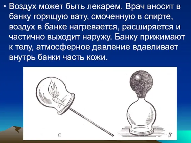 Воздух может быть лекарем. Врач вносит в банку горящую вату, смоченную в