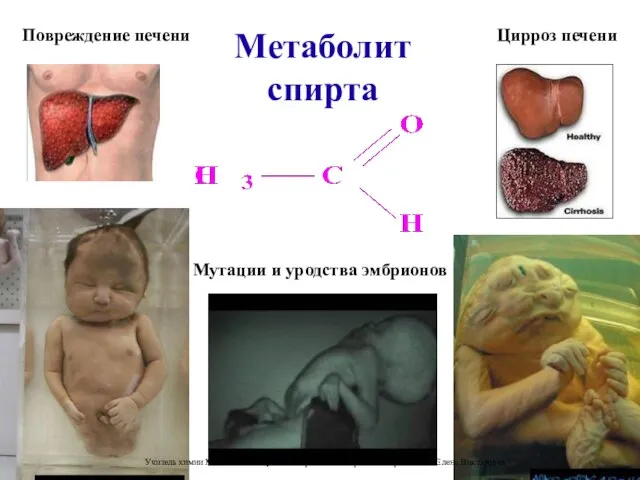 Метаболит спирта Повреждение печени Цирроз печени Мутации и уродства эмбрионов Учитель химии