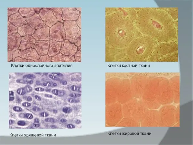 Клетки однослойного эпителия Клетки костной ткани Клетки хрящевой ткани Клетки жировой ткани