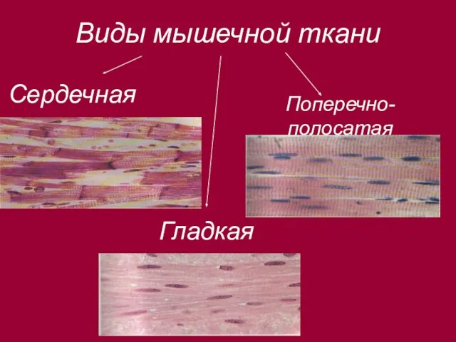 Виды мышечной ткани Сердечная Гладкая Поперечно-полосатая