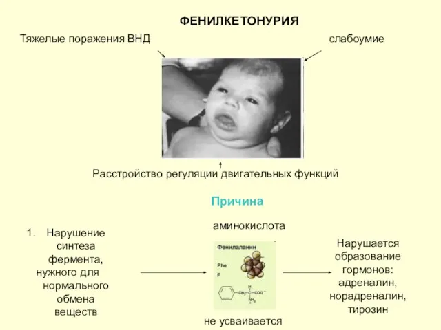 ФЕНИЛКЕТОНУРИЯ Тяжелые поражения ВНД слабоумие Расстройство регуляции двигательных функций Причина Нарушение синтеза