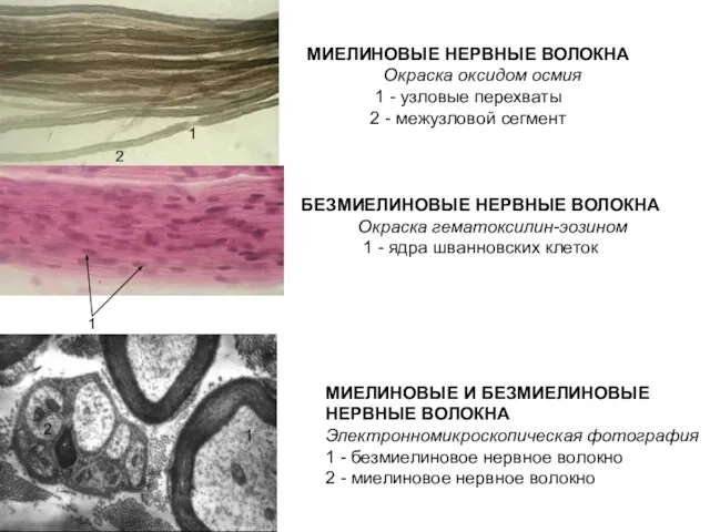 МИЕЛИНОВЫЕ НЕРВНЫЕ ВОЛОКНА Окраска оксидом осмия 1 - узловые перехваты 2 -