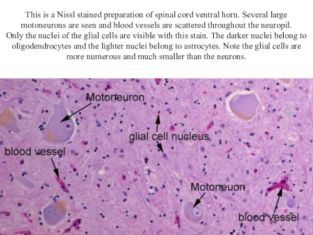 This is a Nissl stained preparation of spinal cord ventral horn. Several