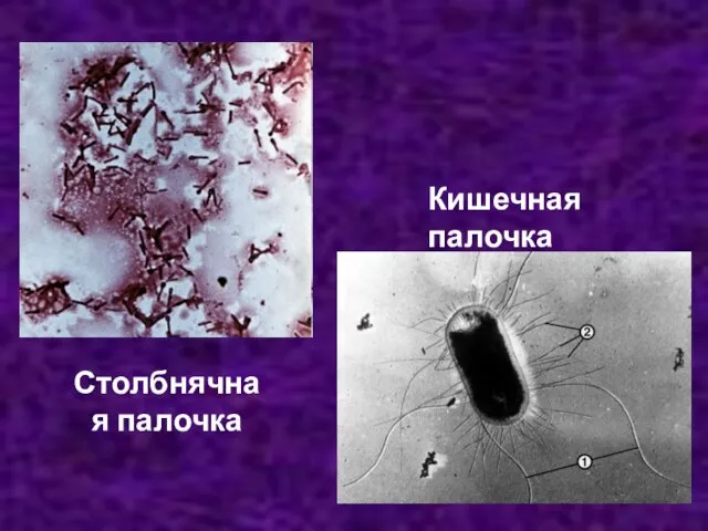 Столбнячная палочка Кишечная палочка