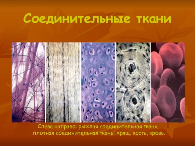Соединительные ткани Слева направо: рыхлая соединительная ткань, плотная соединительная ткань, хрящ, кость, кровь.