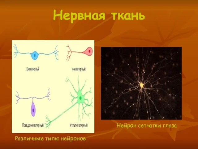 Нервная ткань Различные типы нейронов Нейрон сетчатки глаза