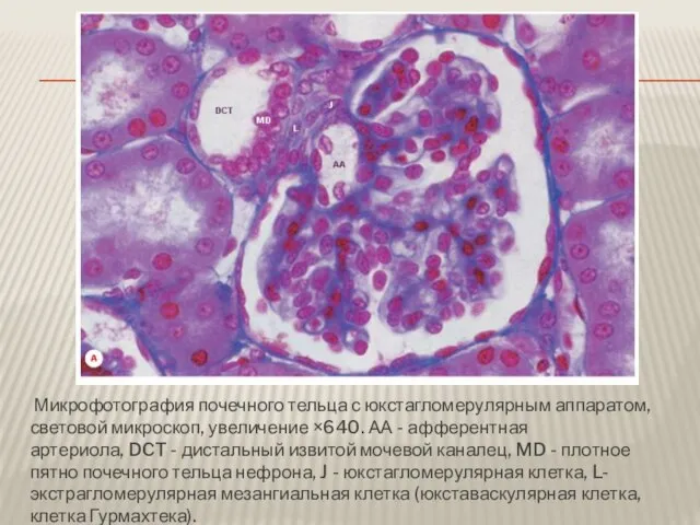 Микрофотография почечного тельца с юкстагломерулярным аппаратом, световой микроскоп, увеличение ×640. АА -