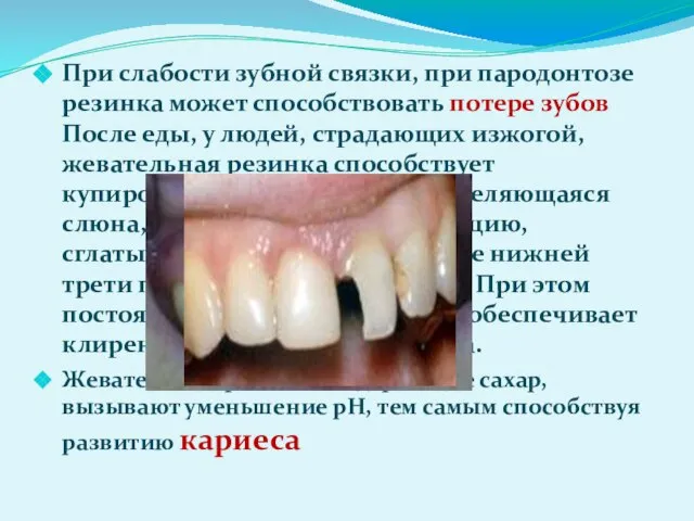 При слабости зубной связки, при пародонтозе резинка может способствовать потере зубов После