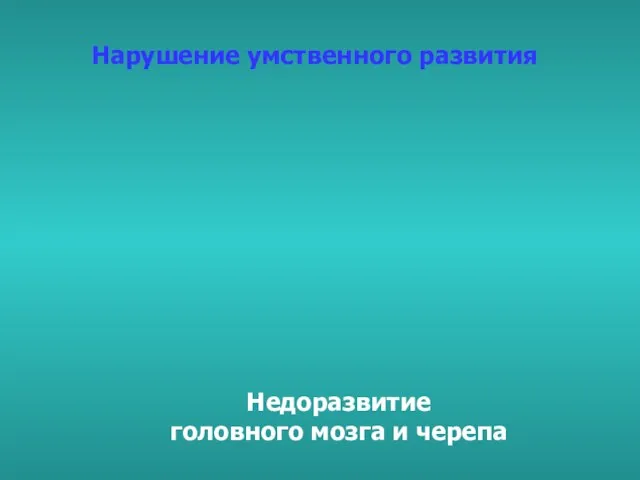 Нарушение умственного развития Недоразвитие головного мозга и черепа