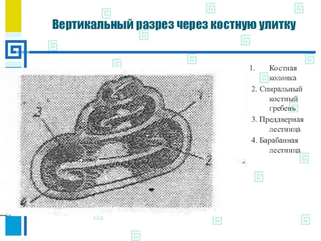 Вертикальный разрез через костную улитку Костная колонка 2. Спиральный костный гребень 3.