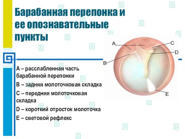 Барабанная перепонка и ее опознавательные пункты A – расслабленная часть барабанной перепонки