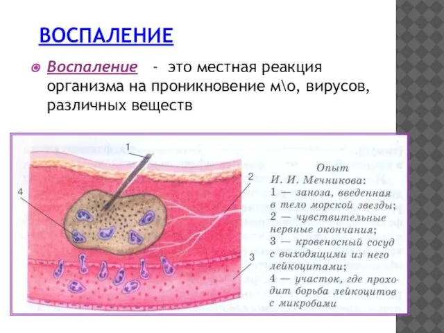 ВОСПАЛЕНИЕ Воспаление - это местная реакция организма на проникновение м\о, вирусов, различных веществ