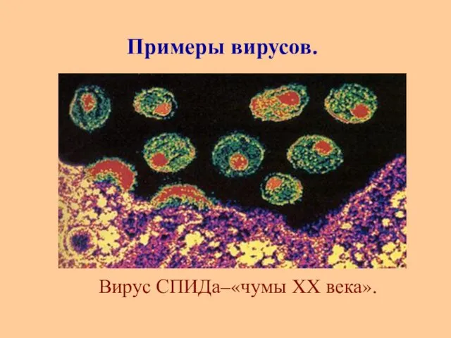 Вирус СПИДа–«чумы XX века». Примеры вирусов.