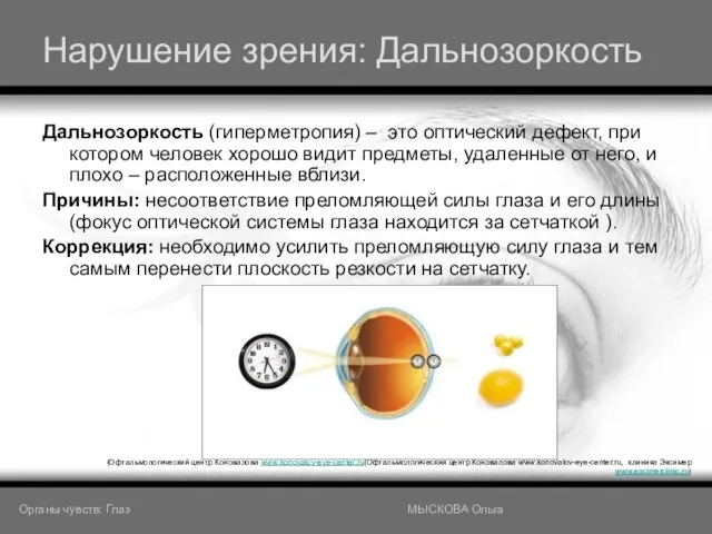 Нарушение зрения: Дальнозоркость Дальнозоркость (гиперметропия) – это оптический дефект, при котором человек