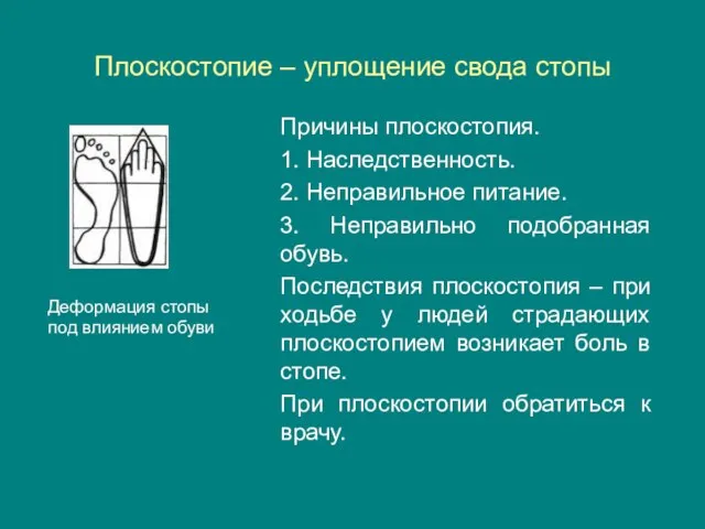 Плоскостопие – уплощение свода стопы Причины плоскостопия. 1. Наследственность. 2. Неправильное питание.