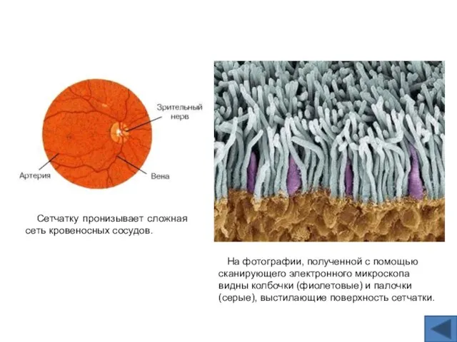 На фотографии, полученной с помощью сканирующего электронного микроскопа видны колбочки (фиолетовые) и