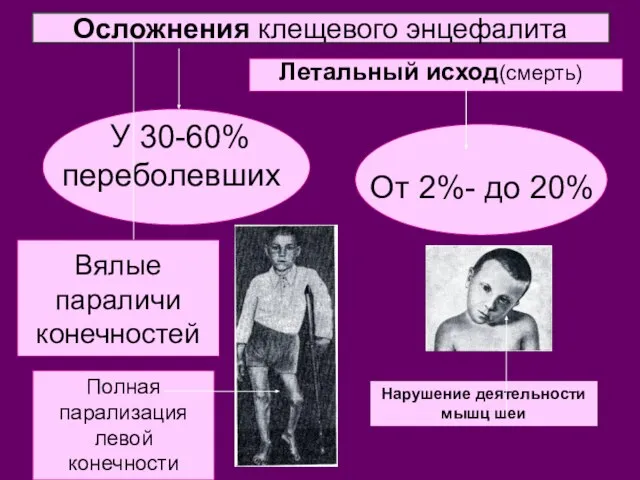 Осложнения клещевого энцефалита У 30-60% переболевших От 2%- до 20% Летальный исход(смерть)