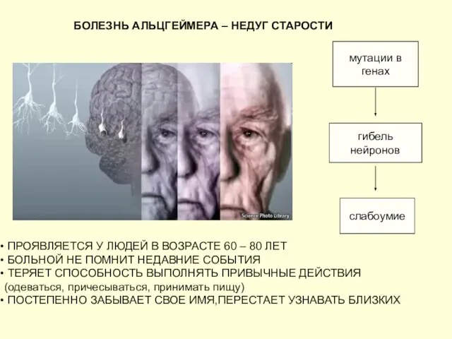 БОЛЕЗНЬ АЛЬЦГЕЙМЕРА – НЕДУГ СТАРОСТИ ПРОЯВЛЯЕТСЯ У ЛЮДЕЙ В ВОЗРАСТЕ 60 –