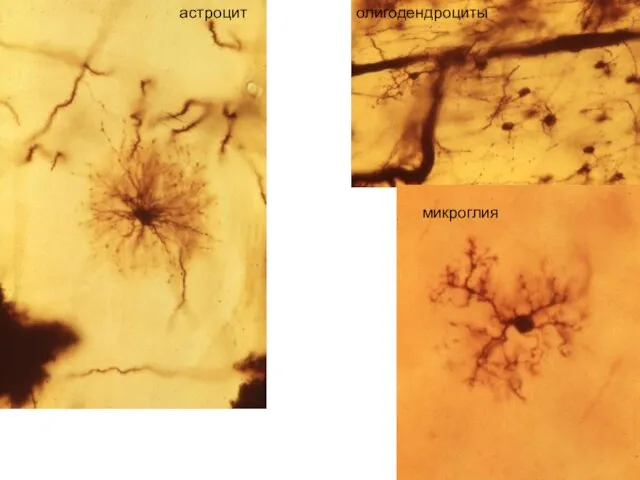 астроцит олигодендроциты микроглия