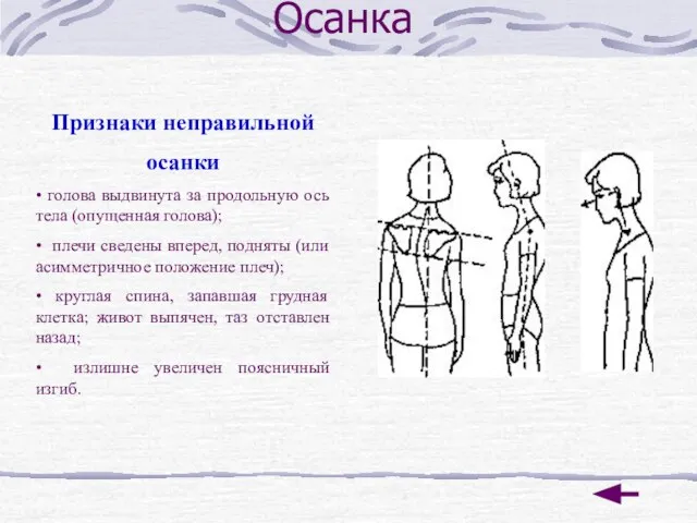 Осанка Признаки неправильной осанки • голова выдвинута за продольную ось тела (опущенная