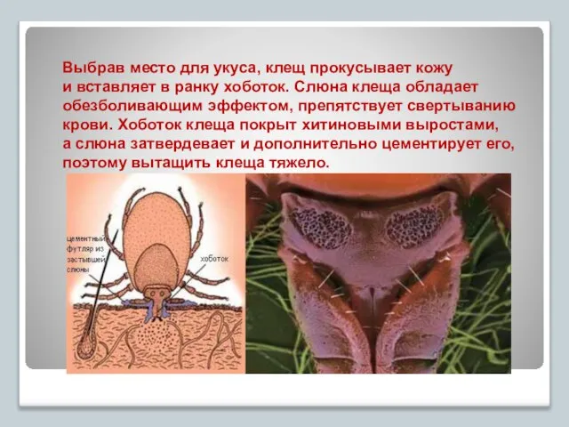 Выбрав место для укуса, клещ прокусывает кожу и вставляет в ранку хоботок.