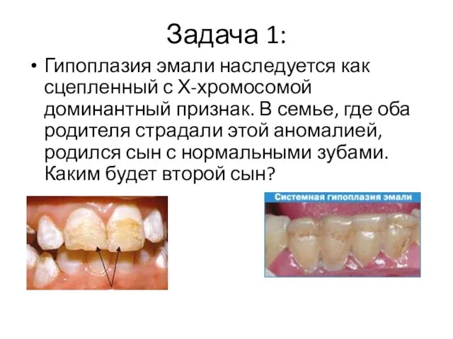 Задача 1: Гипоплазия эмали наследуется как сцепленный с Х-хромосомой доминантный признак. В