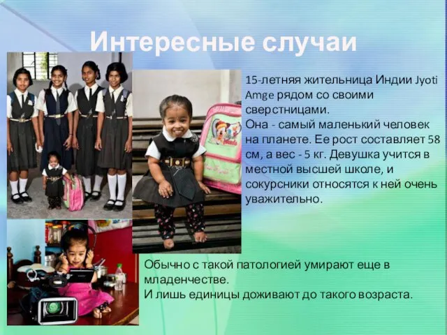 Интересные случаи 15-летняя жительница Индии Jyoti Amge рядом со своими сверстницами. Она