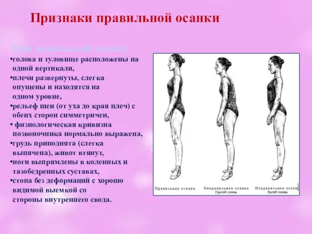 При правильной осанке голова и туловище расположены на одной вертикали, плечи развернуты,