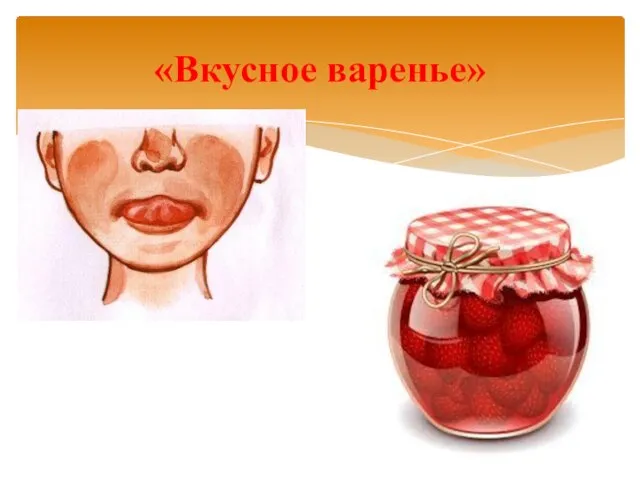 «Вкусное варенье»