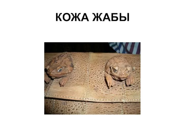 КОЖА ЖАБЫ