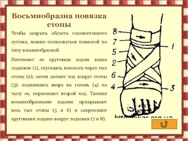 Восьмиобразна повязка стопы Чтобы закрыть область голеностопного сустава, можно пользоваться повязкой по