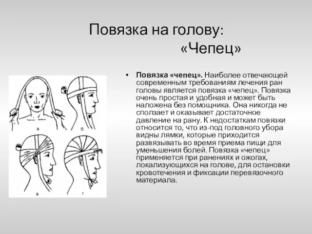 Повязка на голову: «Чепец» Повязка «чепец». Наиболее отвечающей современным требованиям лечения ран