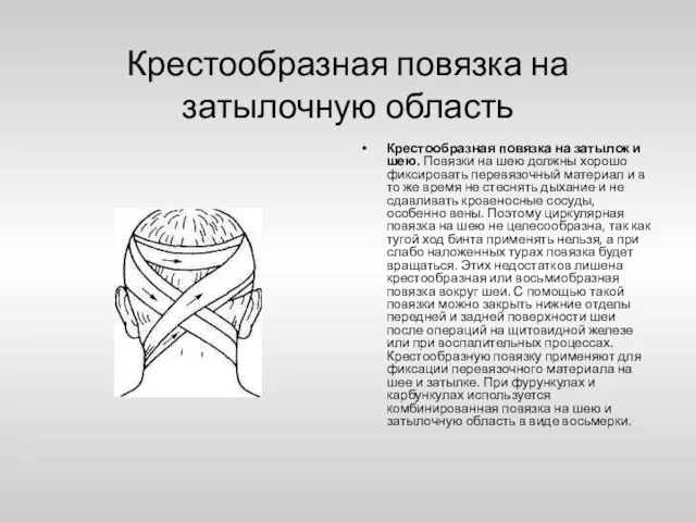 Крестообразная повязка на затылочную область Крестообразная повязка на затылок и шею. Повязки