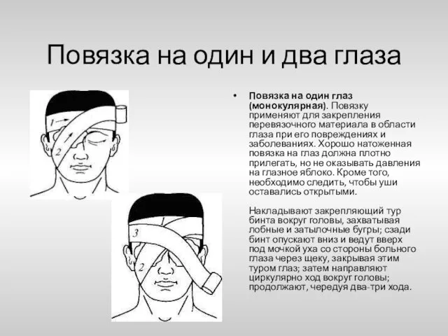 Повязка на один и два глаза Повязка на один глаз (монокулярная). Повязку