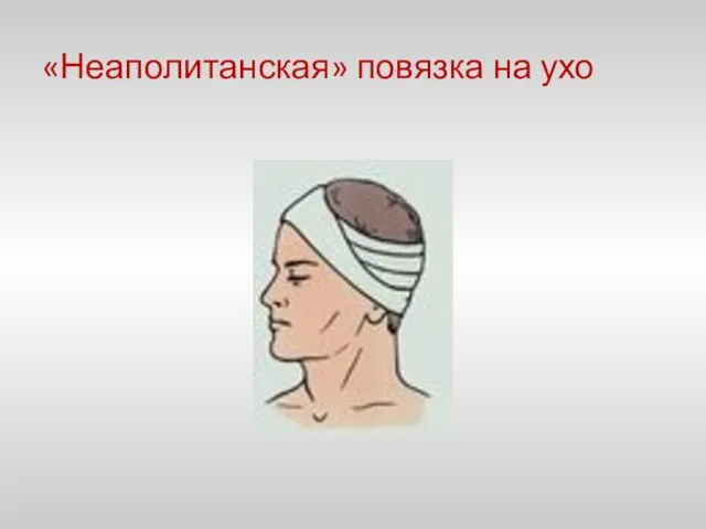 «Неаполитанская» повязка на ухо