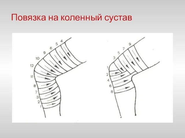 Повязка на коленный сустав